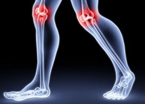 The reasons for the development of knee of artsiller